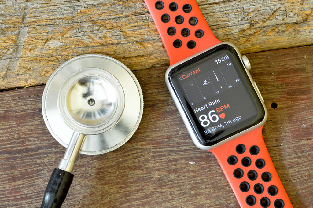 Какъв Apple Watch да купя през 2024 г.?
